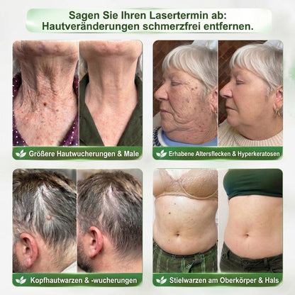 𝑯𝙞𝙨𝙠𝙞𝙣® 🧬𝑷𝑫𝑹𝑵 𝑨𝒏𝒕𝒊-𝑨𝒈𝒊𝒏𝒈 & 𝒈𝒆𝒛𝒊𝒆𝒍𝒕𝒆𝒓 𝑯𝒂𝒖𝒕𝒆𝒓𝒏𝒆𝒖𝒆𝒓𝒖𝒏𝒈𝒔-𝑺𝒕𝒊𝒄𝒌（𝑯𝒊𝒍𝒇𝒕, 𝑭𝒂𝒍𝒕𝒆𝒏 𝒔𝒊𝒄𝒉𝒕𝒃𝒂𝒓 𝒛𝒖 𝒈𝒍ä𝒕𝒕𝒆𝒏, 𝒖𝒏𝒕𝒆𝒓𝒔𝒕ü𝒕𝒛𝒕 𝒆𝒊𝒏 𝒔𝒕𝒓𝒂𝒇𝒇𝒆𝒓 𝒘𝒊𝒓𝒌𝒆𝒏𝒅𝒆𝒔 𝑯𝒂𝒖𝒕𝒃𝒊𝒍𝒅 𝒖𝒏𝒅 𝒗𝒆𝒓𝒃𝒆𝒔𝒔𝒆𝒓𝒕 𝒅𝒂𝒔 𝑬𝒓𝒔𝒄𝒉𝒆𝒊𝒏𝒖𝒏𝒈𝒔𝒃𝒊𝒍𝒅 𝒔𝒊𝒄𝒉𝒕𝒃𝒂𝒓𝒆𝒓 𝑯𝒂𝒖𝒕𝒇𝒍𝒆𝒄𝒌𝒆𝒏）
