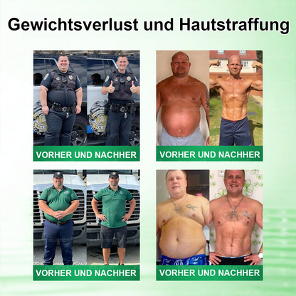 InsLemon® Moringa × Berberin × AMPK 10-in-1 Nano-Mikronadel-Pflaster für Stoffwechsel-Support (1× täglich) ✅ Unterstützt Stoffwechsel, Appetitkontrolle, Energie & Gewichtsmanagement
