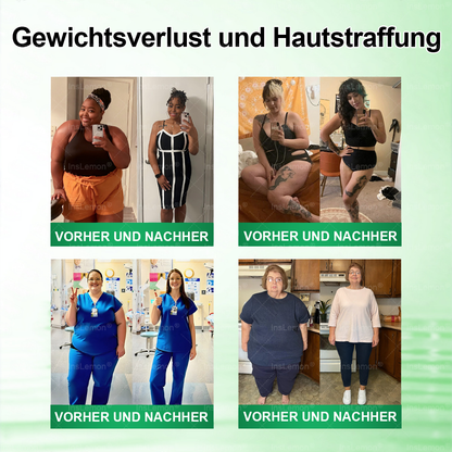 InsLemon® Moringa × Berberin × AMPK 10-in-1 Nano-Mikronadel-Pflaster für Stoffwechsel-Support (1× täglich) ✅ Unterstützt Stoffwechsel, Appetitkontrolle, Energie & Gewichtsmanagement